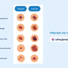 Porównanie pieprzyka i czerniaka: asymetria, brzegi, kolor, średnica i ewolucja to kluczowe czynniki pomagające rozpoznać czerniak objawy.