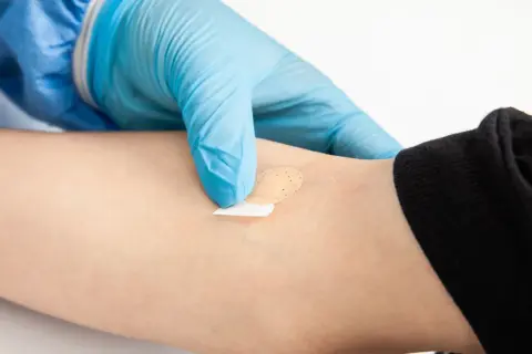 Ręka w niebieskiej rękawiczce zakłada plaster na ramię po pobraniu krwi do badania kortyzolu.