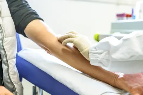 Podwyższony poziom płytek krwi – co oznacza, przyczyny i zagrożenia zdrowotne