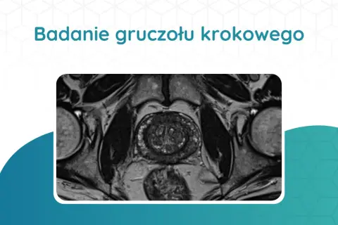 Przekrój rezonansu magnetycznego miednicy, ukazujący badanie prostaty.