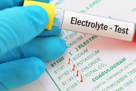 Rękawiczka w niebieskiej rękawiczce trzyma probówkę z napisem "Electrolyte - Test". Obok widać formularz z badaniami, w tym "COAGULOGRAM".