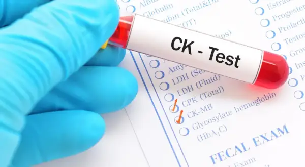 Rękawiczka trzyma probówkę z krwią do testu CK. Na formularzu zaznaczono kinazę kreatynową (CK-MB).