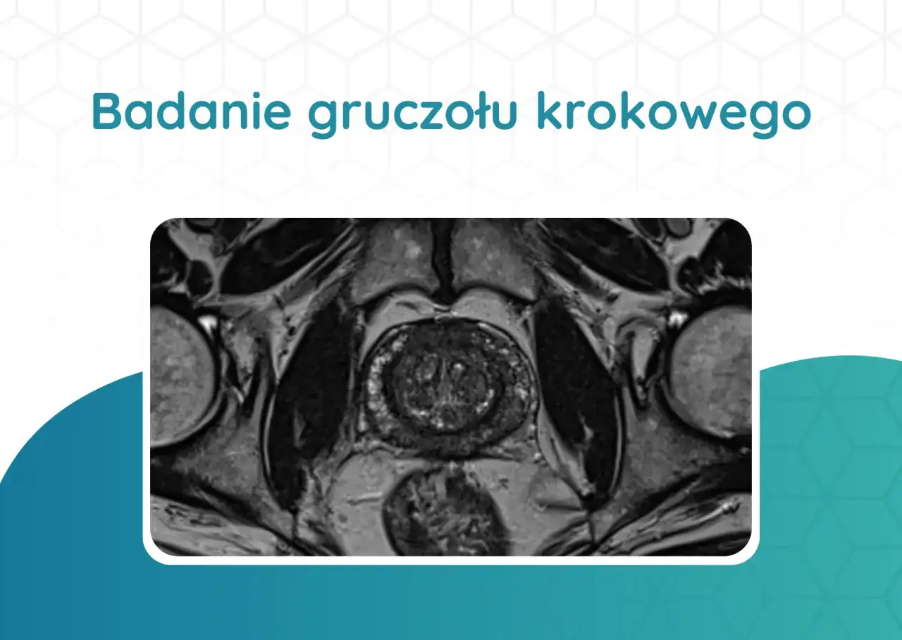 Badanie prostaty krok po kroku. PSA, USG i rezonans