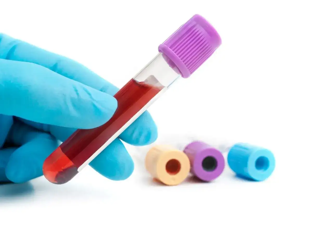 Hemoglobina glikowana HbA1c - jak czytać wynik i kiedy badać?