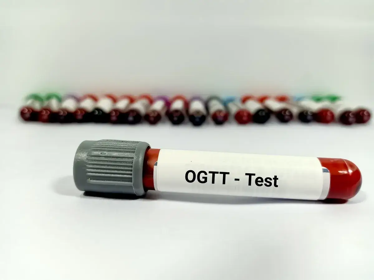 Probówki z krwią do testu OGTT, który pozwala ocenić krzywą cukrową. W tle rząd innych próbek.