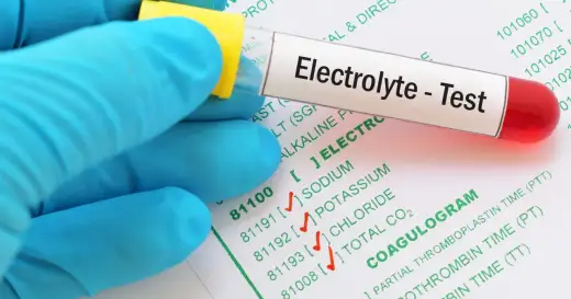 Jonogram - co pokazuje badanie elektrolitów?