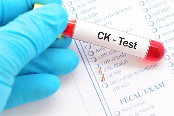 Rękawiczka trzyma probówkę z krwią do testu CK. Na formularzu zaznaczono kinazę kreatynową (CK-MB).