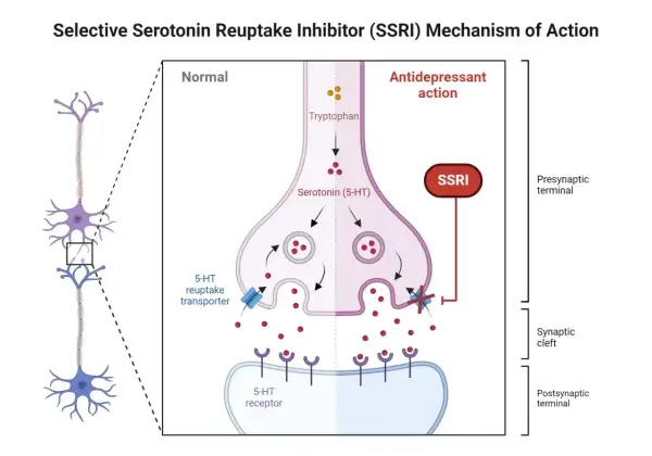 Schemat działania SSRI: blokowanie wychwytu zwrotnego serotoniny w synapsie, zwiększając jej dostępność.