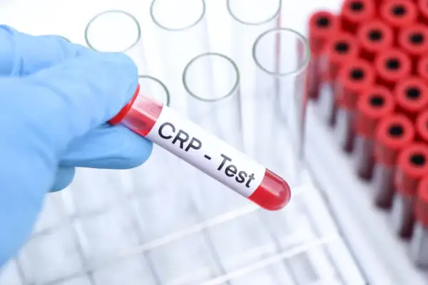 Ręka w niebieskiej rękawiczce trzyma probówkę z napisem "CRP - Test". To badanie pomaga ocenić stan zapalny w organizmie.